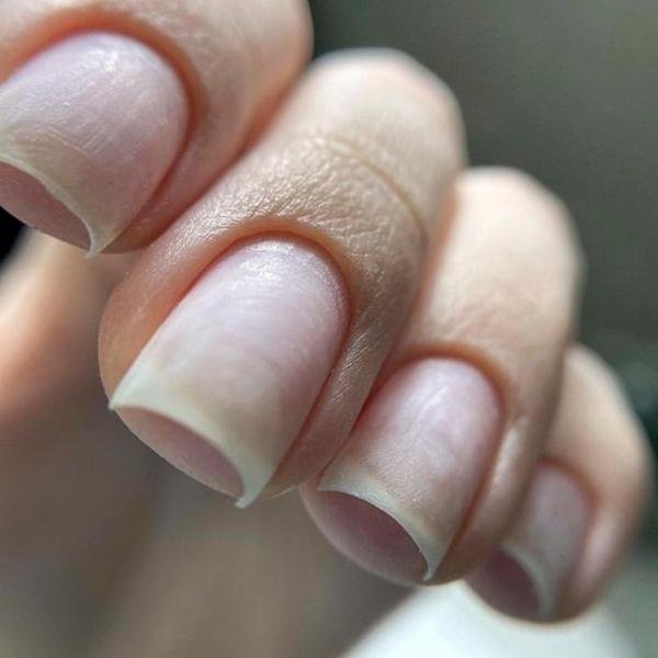Retiro de Uñas