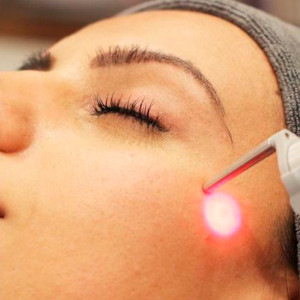 Tratamiento para Hiperpigmentación