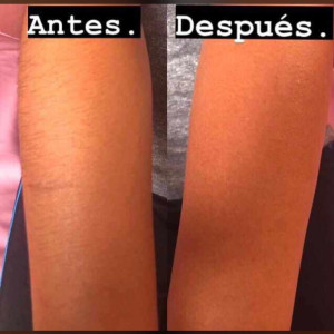 Depilación con Cera - Brazos