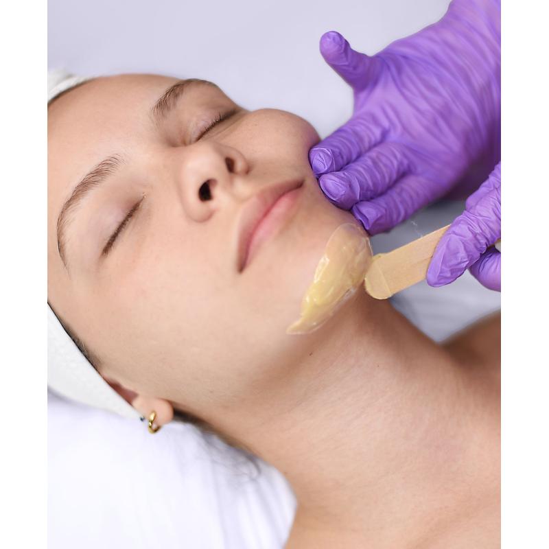 Depilación de Mentón