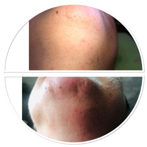 Depilación con Cera - Barbilla